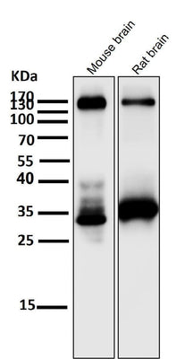 Anti-TrkA+B+C NTRK1 Rabbit Monoclonal Antibody Boster Bio