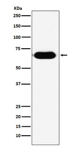 Anti-RNF8 Rabbit Monoclonal Antibody Boster Bio