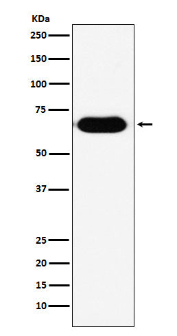 Anti-RNF8 Rabbit Monoclonal Antibody Boster Bio