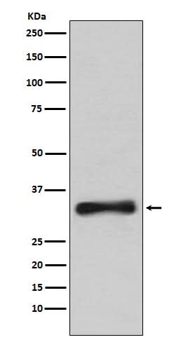 Anti-Emerin Rabbit Monoclonal Antibody Boster Bio