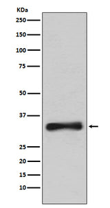 Anti-Emerin Rabbit Monoclonal Antibody Boster Bio