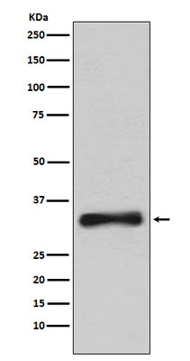 Anti-Emerin Rabbit Monoclonal Antibody Boster Bio