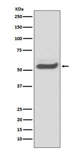 Anti-SERPINA1/Alpha 1 Antitrypsin Rabbit Monoclonal Antibody Boster Bio