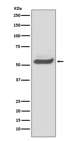 Anti-SERPINA1/Alpha 1 Antitrypsin Rabbit Monoclonal Antibody Boster Bio