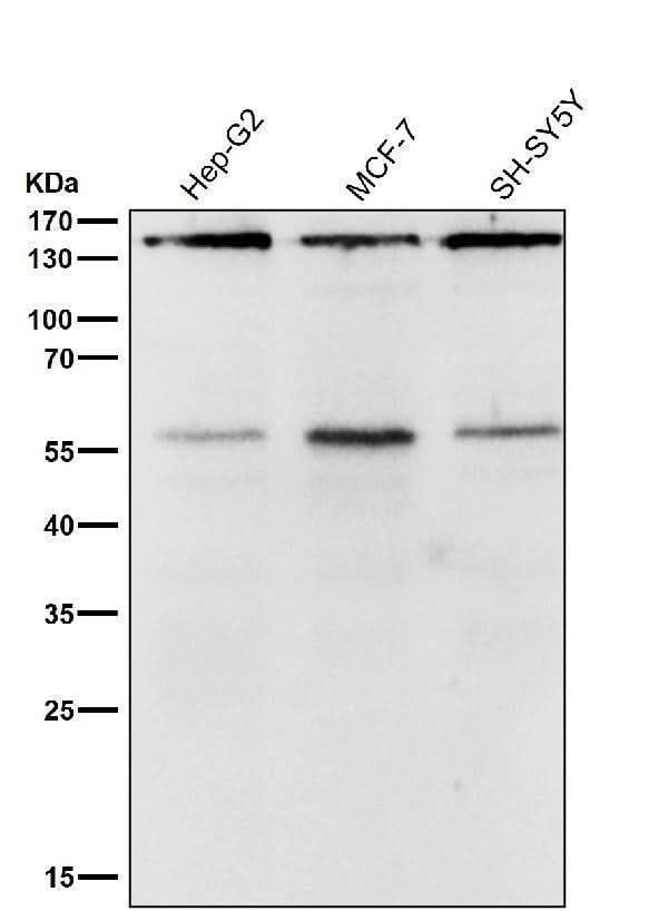 Anti-ROCK1 Rabbit Monoclonal Antibody Boster Bio