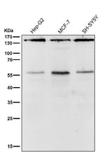 Anti-ROCK1 Rabbit Monoclonal Antibody Boster Bio