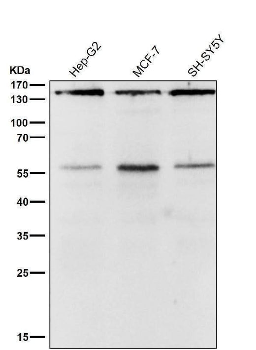 Anti-ROCK1 Rabbit Monoclonal Antibody Boster Bio