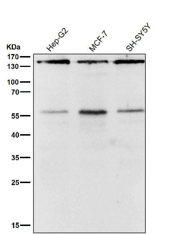 Anti-ROCK1 Rabbit Monoclonal Antibody Boster Bio