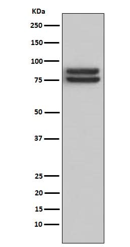 Anti-FOXP1 Monoclonal Antibody Boster Bio