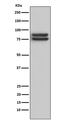 Anti-FOXP1 Monoclonal Antibody Boster Bio