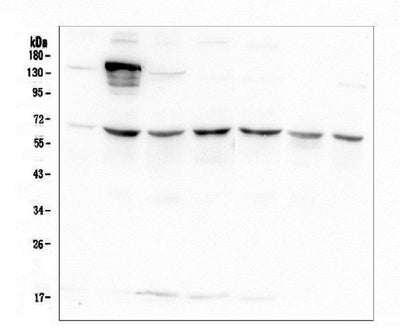 Anti-AKT2 Antibody Picoband® (monoclonal, 10C6 Boster Bio
