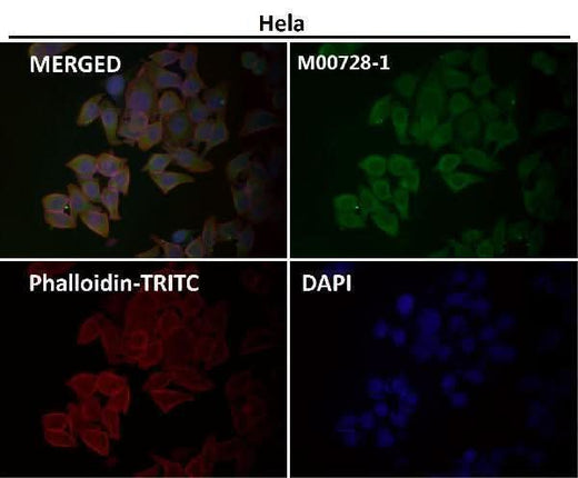 Anti-Smad1 Rabbit Monoclonal Antibody Boster Bio