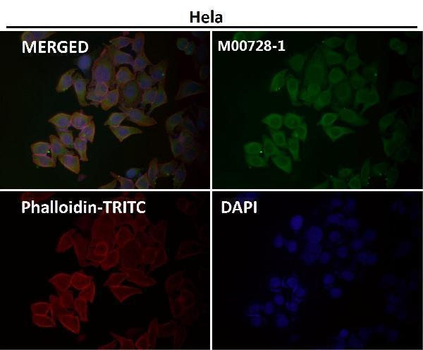 Anti-Smad1 Rabbit Monoclonal Antibody Boster Bio
