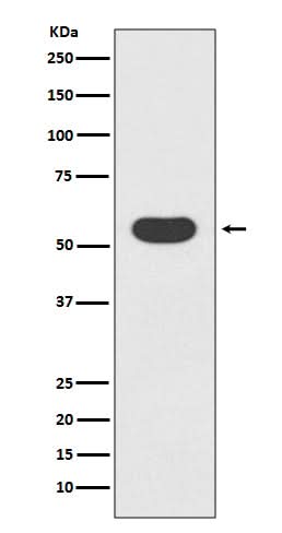 Anti-Smad1 Rabbit Monoclonal Antibody Boster Bio