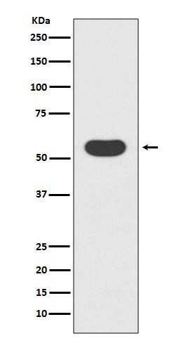 Anti-Smad1 Rabbit Monoclonal Antibody Boster Bio