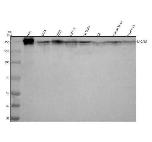 Anti-L1CAM Rabbit Monoclonal Antibody Boster Bio