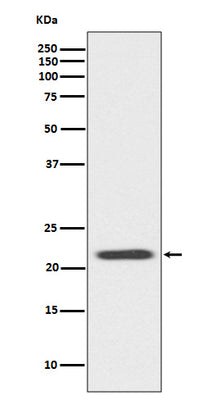 Anti-Bid Rabbit Monoclonal Antibody Boster Bio