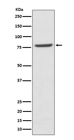 Anti-Mre11 MRE11A Rabbit Monoclonal Antibody Boster Bio