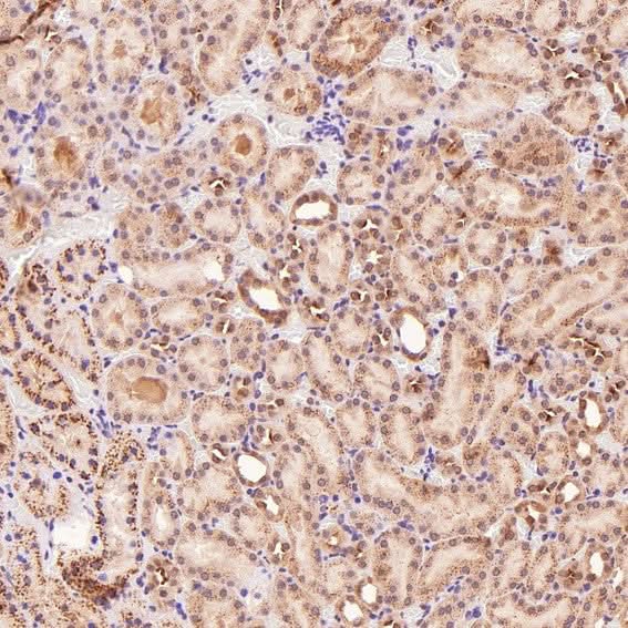 Anti-p95/NBS1 NBN Rabbit Monoclonal Antibody Boster Bio