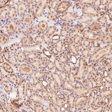 Anti-p95/NBS1 NBN Rabbit Monoclonal Antibody Boster Bio