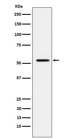 Anti-MMP1 Rabbit Monoclonal Antibody Boster Bio