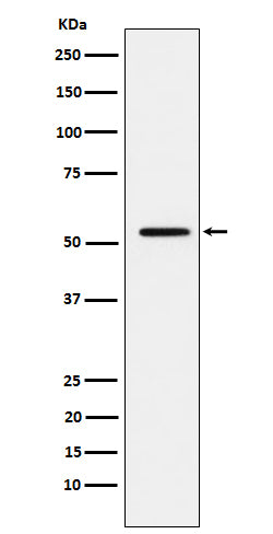 Anti-MMP1 Rabbit Monoclonal Antibody Boster Bio