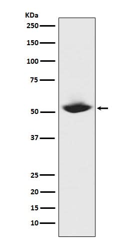 Anti-MMP1 Rabbit Monoclonal Antibody Boster Bio