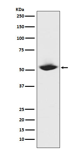 Anti-MMP1 Rabbit Monoclonal Antibody Boster Bio
