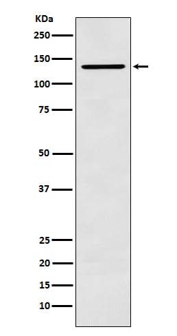 Anti-CARD11 Rabbit Monoclonal Antibody Boster Bio