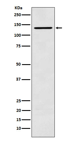 Anti-CARD11 Rabbit Monoclonal Antibody Boster Bio