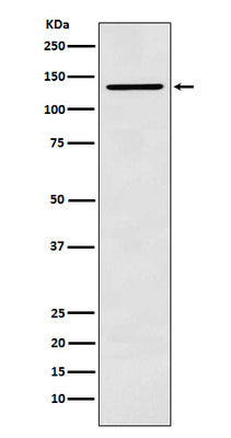 Anti-CARD11 Rabbit Monoclonal Antibody Boster Bio