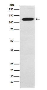 Anti-Ctip1 Monoclonal Antibody Boster Bio