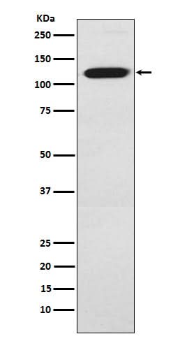 Anti-Ctip1 Monoclonal Antibody Boster Bio
