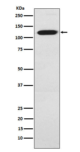 Anti-Ctip1 Monoclonal Antibody Boster Bio