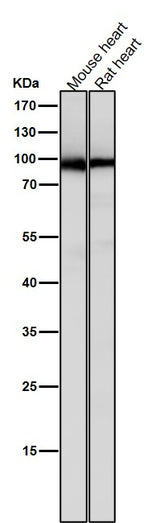 Anti-PKC Rabbit Monoclonal Antibody Boster Bio