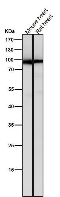 Anti-PKC Rabbit Monoclonal Antibody Boster Bio