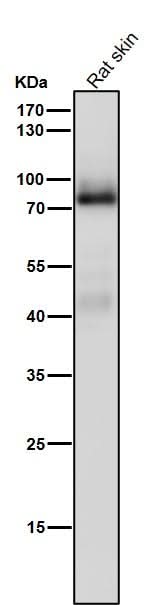 Anti-PKC Rabbit Monoclonal Antibody Boster Bio