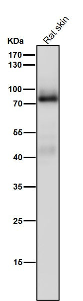 Anti-PKC Rabbit Monoclonal Antibody Boster Bio