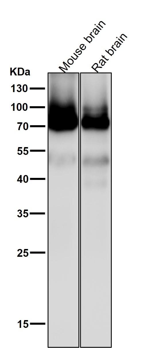 Anti-PKC Rabbit Monoclonal Antibody Boster Bio