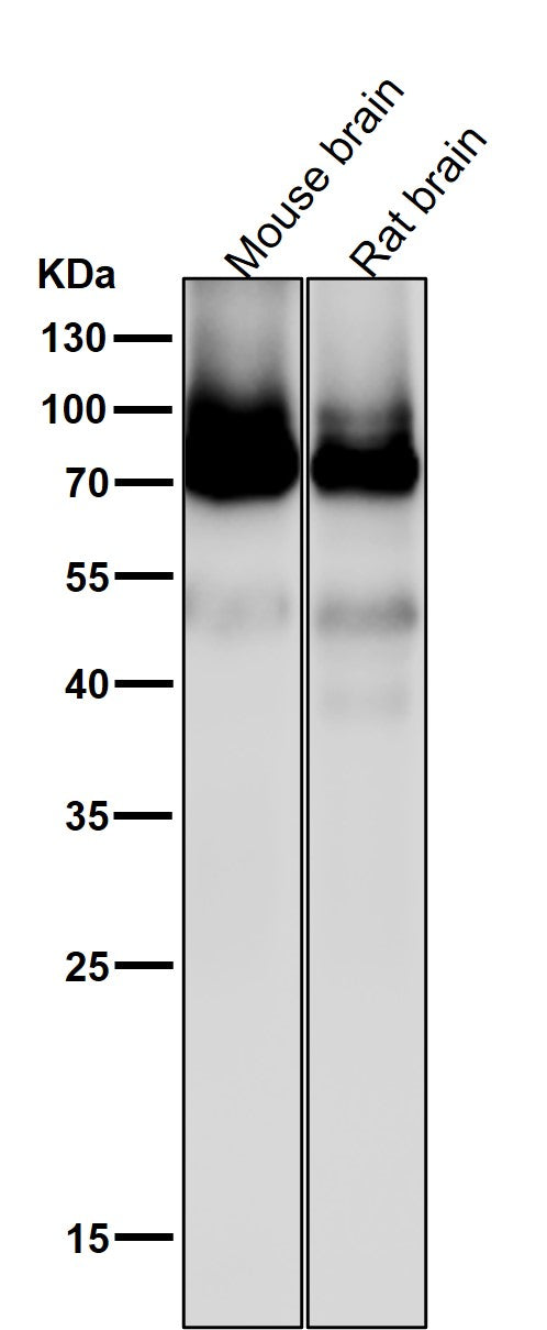 Anti-PKC Rabbit Monoclonal Antibody Boster Bio