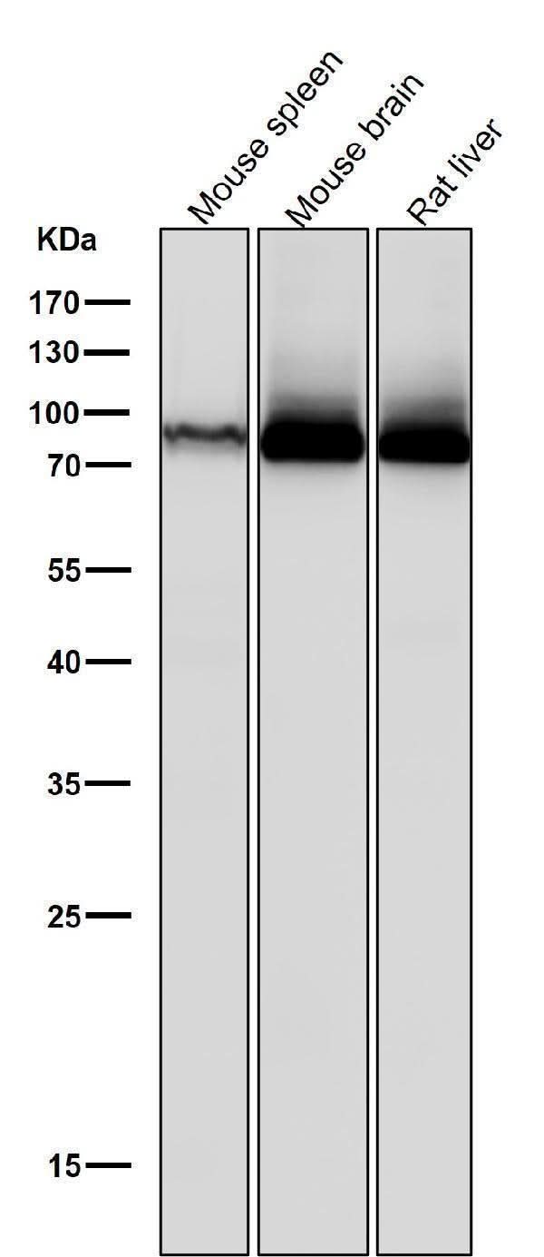 Anti-PKC Rabbit Monoclonal Antibody Boster Bio
