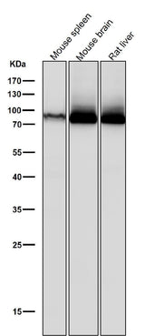 Anti-PKC Rabbit Monoclonal Antibody Boster Bio
