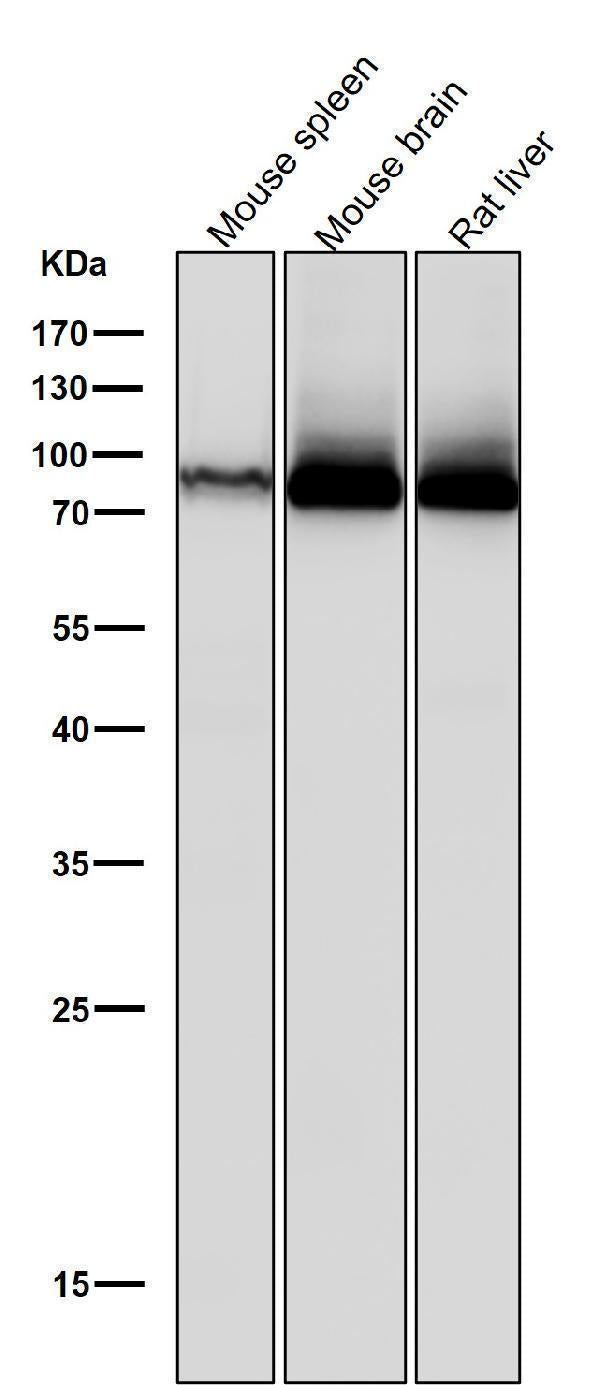 Anti-PKC Rabbit Monoclonal Antibody Boster Bio