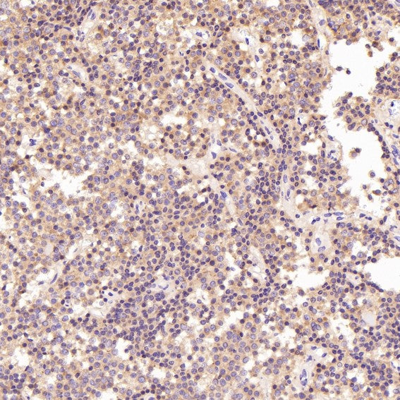 Anti-PKC alpha PRKCA Rabbit Monoclonal Antibody Boster Bio