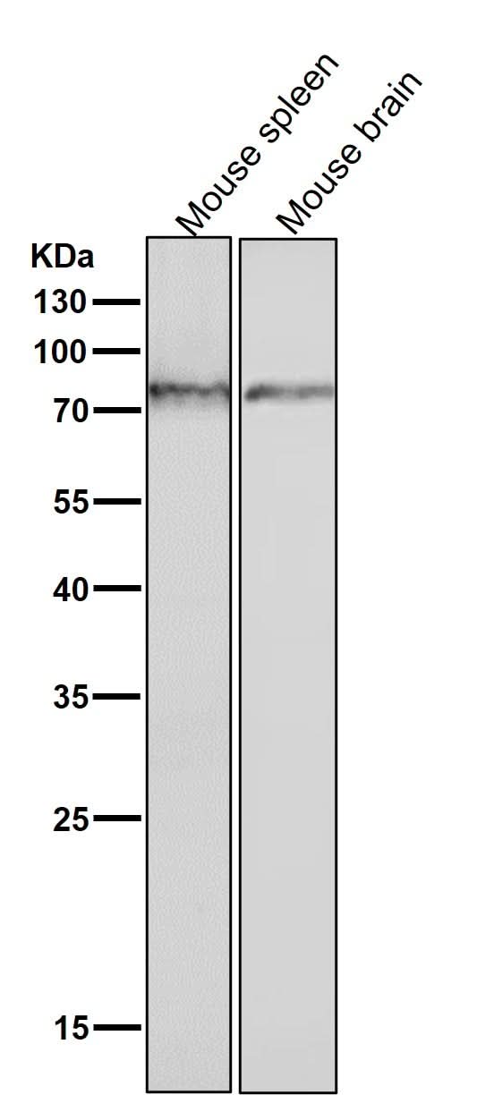 Anti-Phospho-PKC (S729) Rabbit Monoclonal Antibody Boster Bio