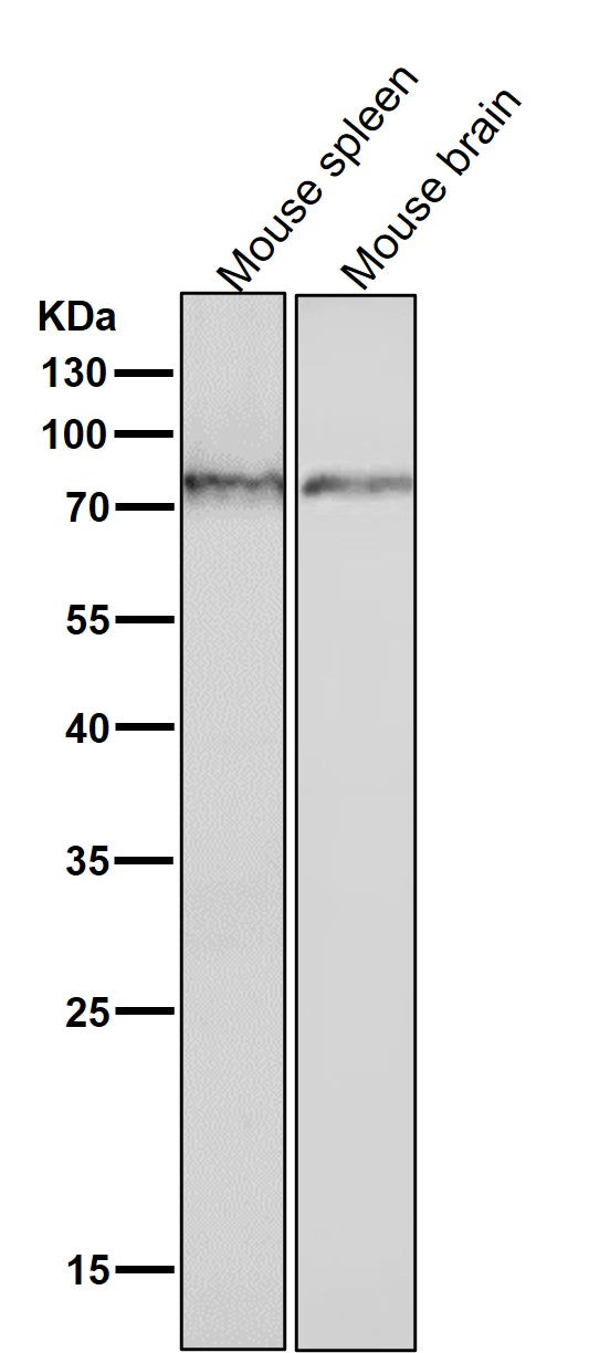 Anti-Phospho-PKC (S729) Rabbit Monoclonal Antibody Boster Bio