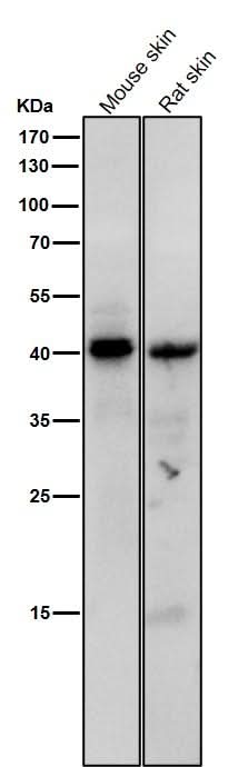 Anti-Phospho-PKA C (Thr197) Rabbit Monoclonal Antibody Boster Bio
