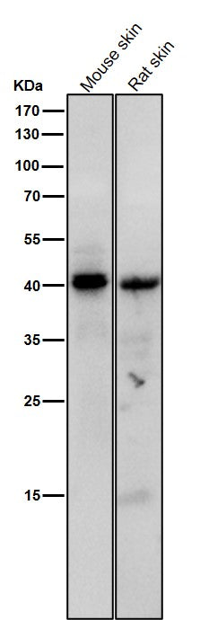 Anti-Phospho-PKA C (Thr197) Rabbit Monoclonal Antibody Boster Bio