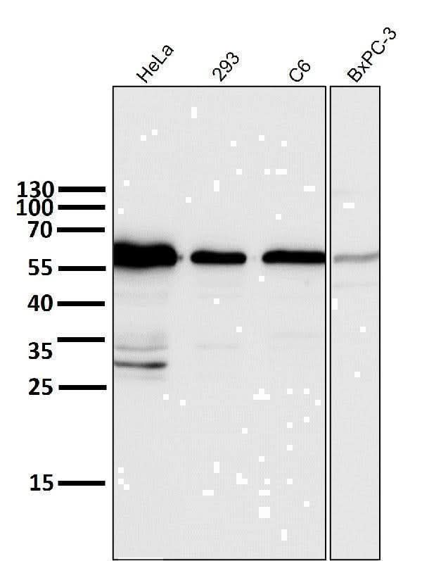 Anti-Cyclin B1 CCNB1 Rabbit Monoclonal Antibody Boster Bio
