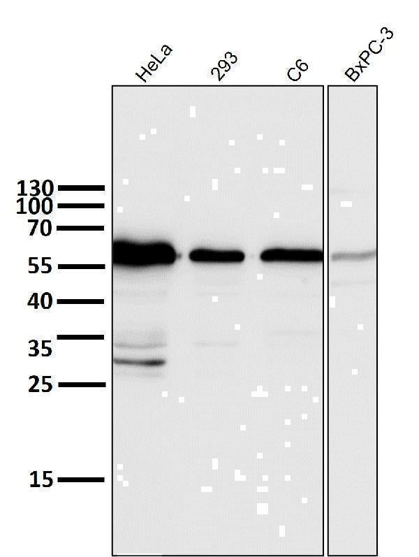 Anti-Cyclin B1 CCNB1 Rabbit Monoclonal Antibody Boster Bio